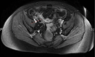 Imagen: British Medical Journal